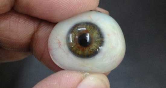 تعبیر خواب چشم قرمز مرده